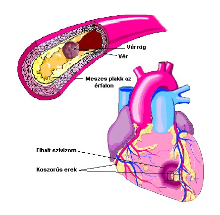 lizin és a szív egészsége